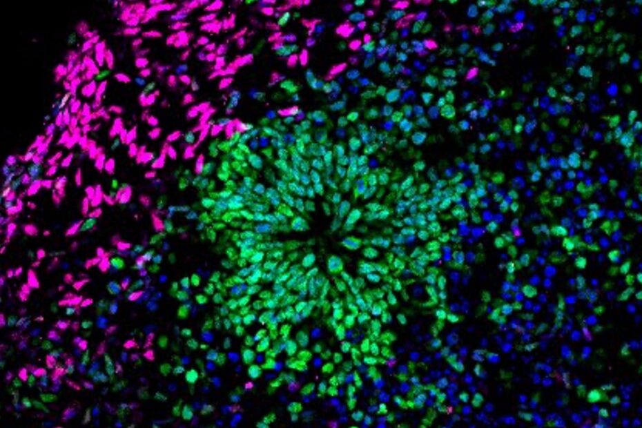 Forebrain Organoid_Kristy_Welshhans Forebrain Organoid_Kristy_Welshhans